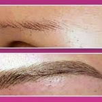 تصویر 1 میکروپیگمنتیشن مژگان