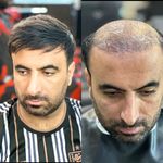 تصویر 1 آرایشگاه مردانه مرکز تخصصی داماد حامد دهقانی