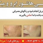 تصویر 0 مرکز میکروپیگمنتیشن دکتر دیهیم