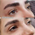 تصویر 3 میکرو بلیدینگ و تتو بدن و کاشت ناخن