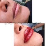 تصویر 3 میکرو بلیدینگ و تتو بدن و کاشت ناخن