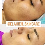 تصویر 2 پاکسازی پوست و درمان مشکلات پوستی