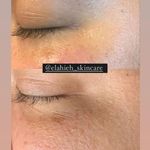 تصویر 3 پاکسازی پوست و درمان مشکلات پوستی