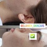 تصویر 0 پاکسازی پوست و درمان مشکلات پوستی