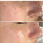 تصویر 3 پاکسازی پوست و درمان مشکلات پوستی