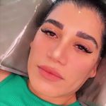 تصویر 2 کاشت و اکستنشن مژه زهرا کاظمی