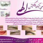 تصویر 3 مرکز فوق تخصصی میکروپیگمنتیشن الهه