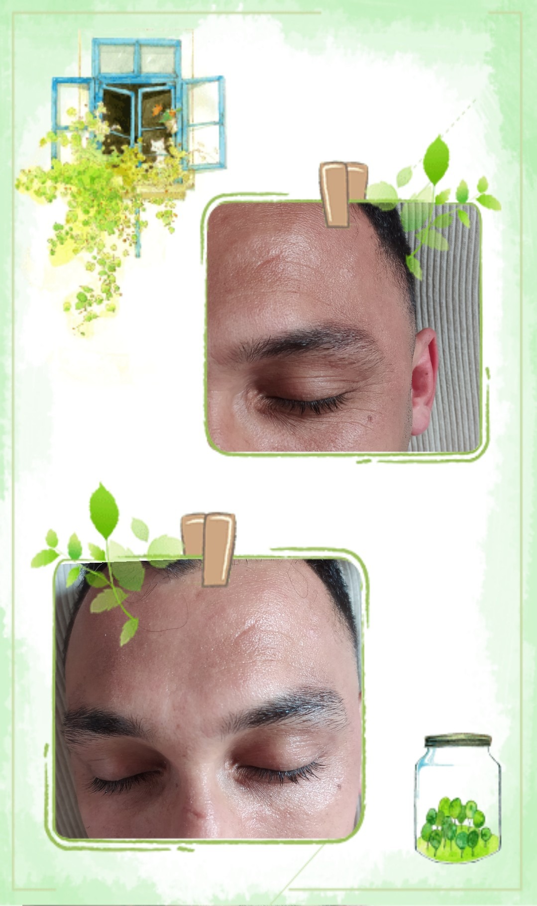پاکسازی پوست فرشته