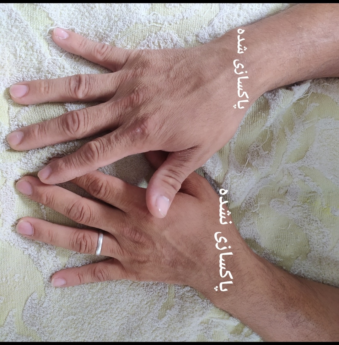 پاکسازی پوست فرشته