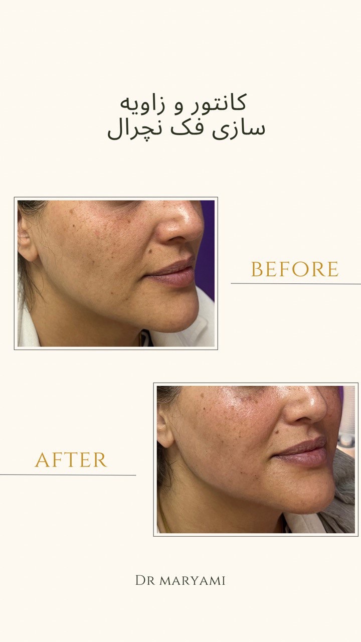 کلینیک پوست مو زیبایی دکتر نیلوفر مریمی