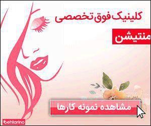 سالن میکرو آرزو