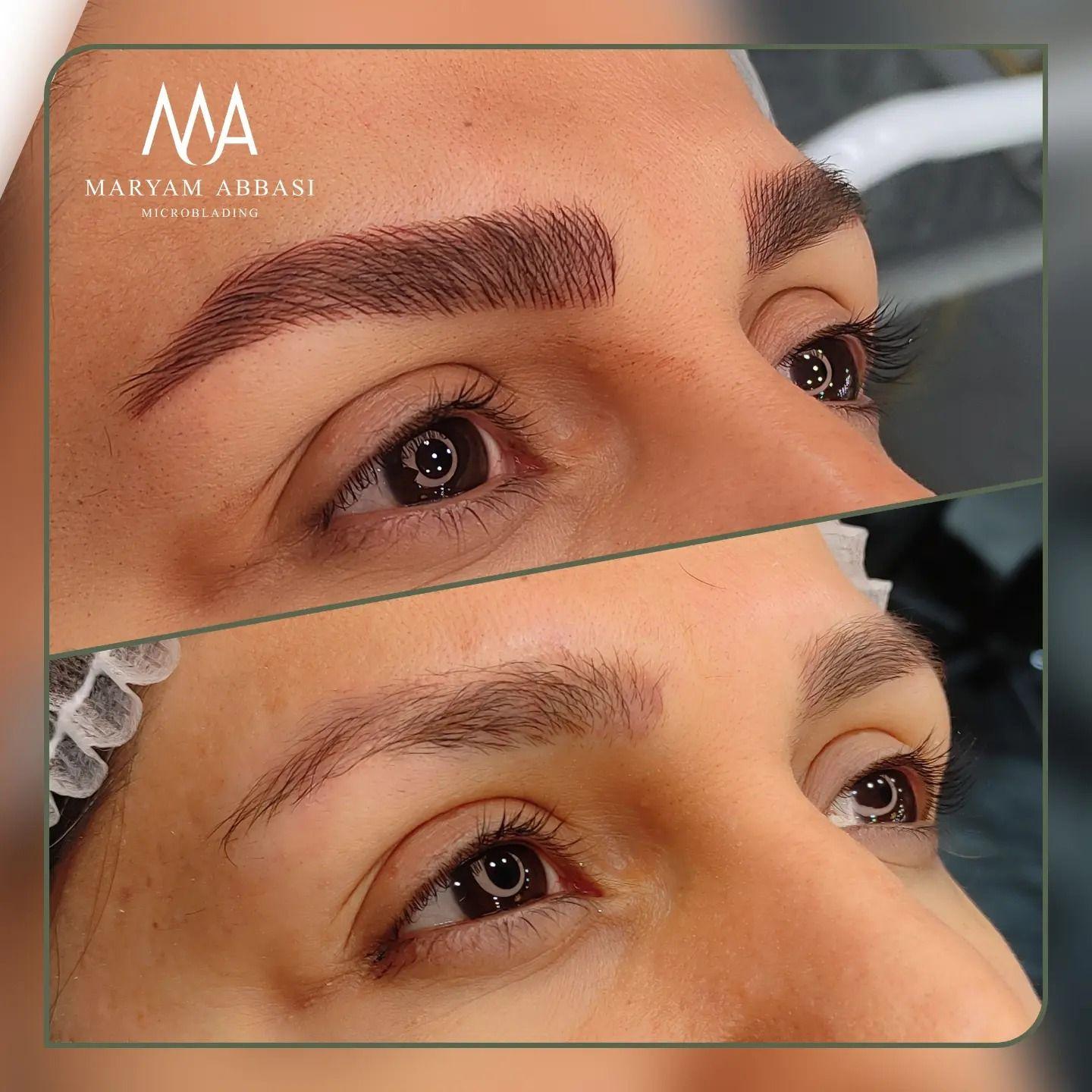 میکروبلیدینگ ( فیبروز ) لیفت مژه و ابرو