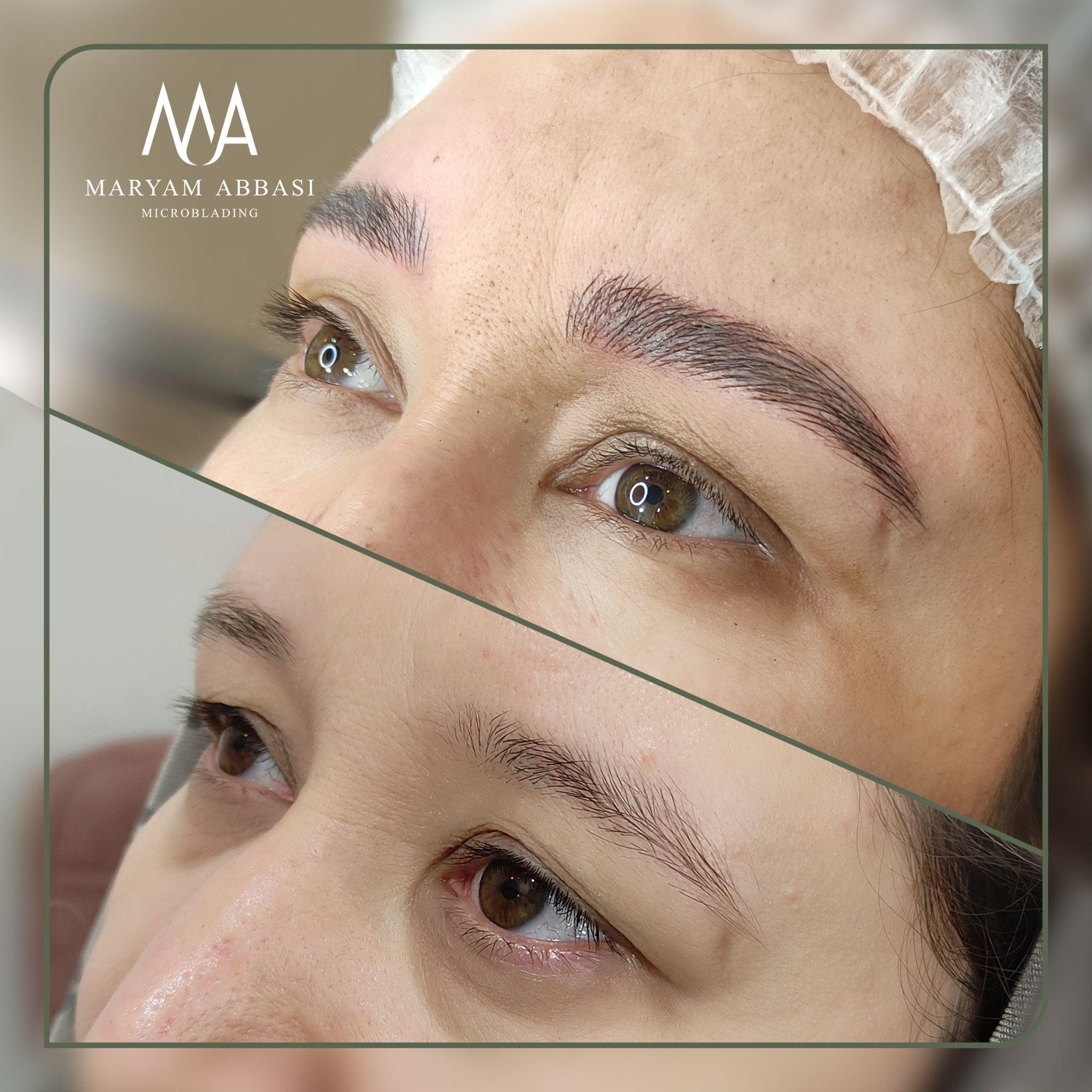 میکروبلیدینگ ( فیبروز ) لیفت مژه و ابرو