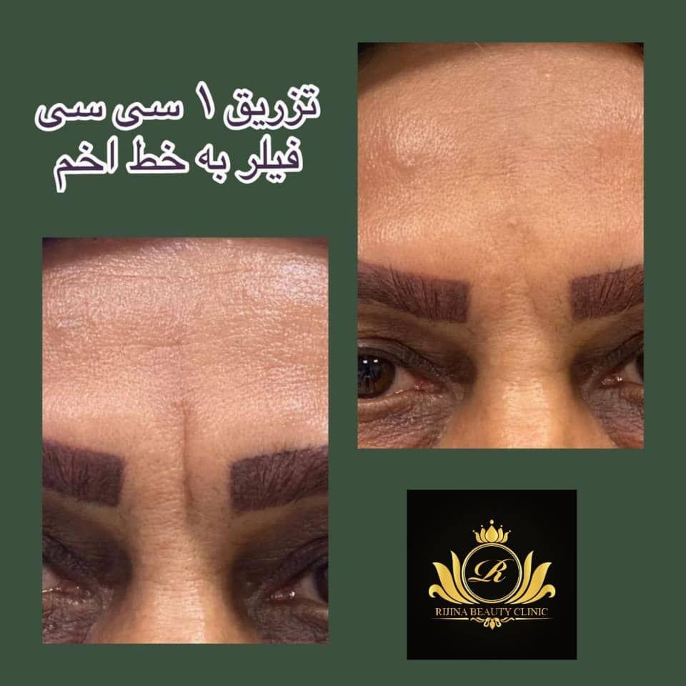 کلینیک زیبایی ریجینا