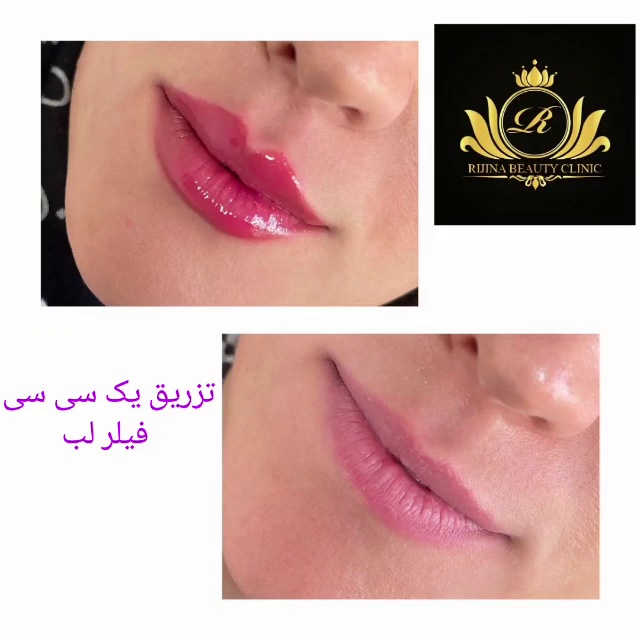 کلینیک زیبایی ریجینا