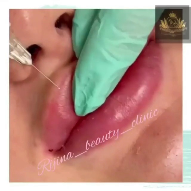 کلینیک زیبایی ریجینا