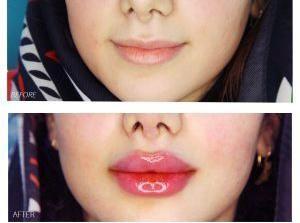 کلینیک زیبایی ریجینا