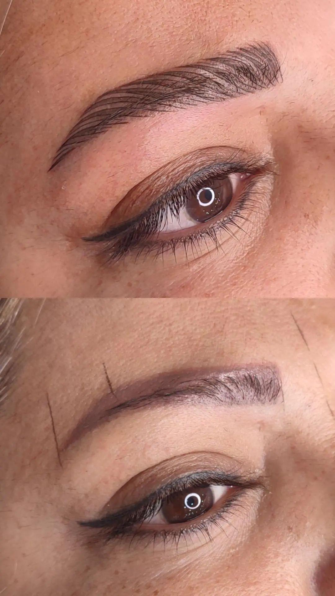 مرکز خدمات و آموزش میکروبلیدینگ ، میکروپیگمنتیشن و ریموو