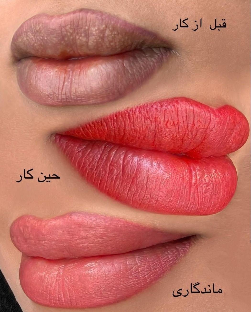 مرکز خدمات و آموزش میکروبلیدینگ ، میکروپیگمنتیشن و ریموو