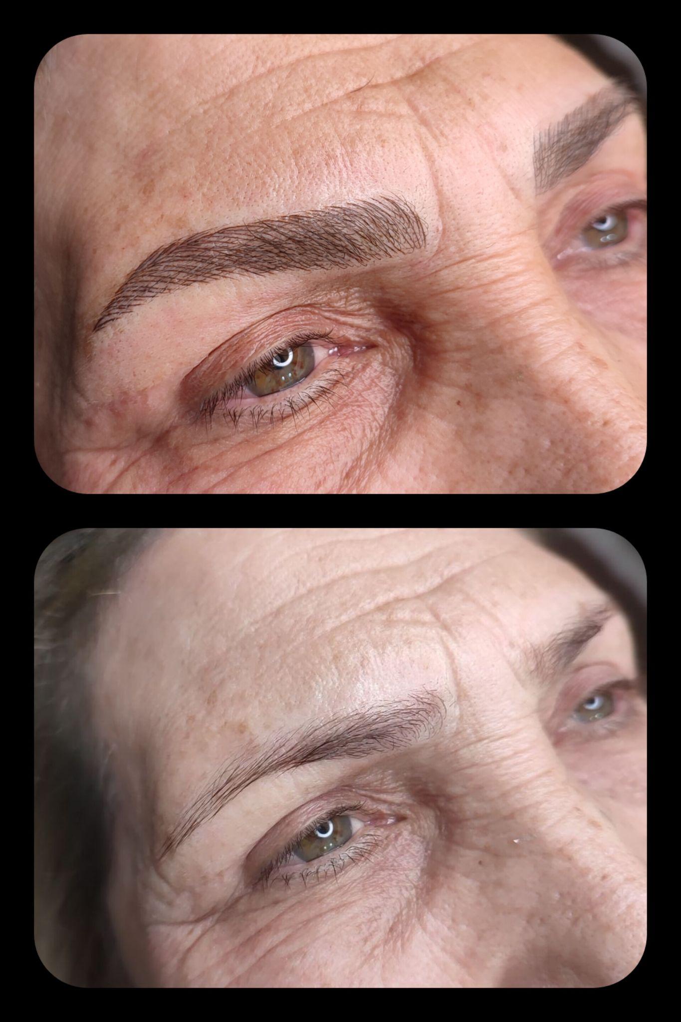 مرکز خدمات و آموزش میکروبلیدینگ ، میکروپیگمنتیشن و ریموو