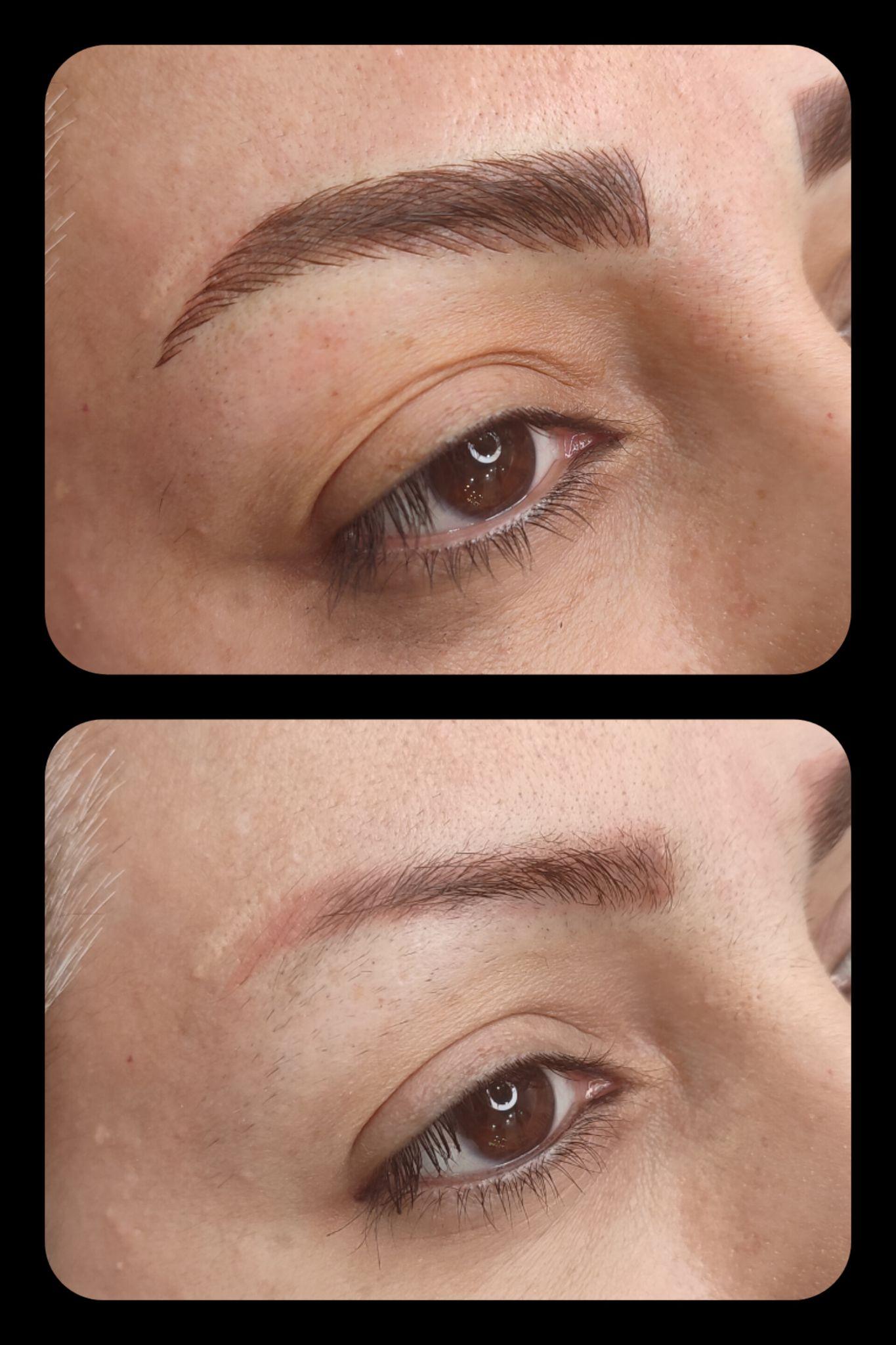 مرکز خدمات و آموزش میکروبلیدینگ ، میکروپیگمنتیشن و ریموو