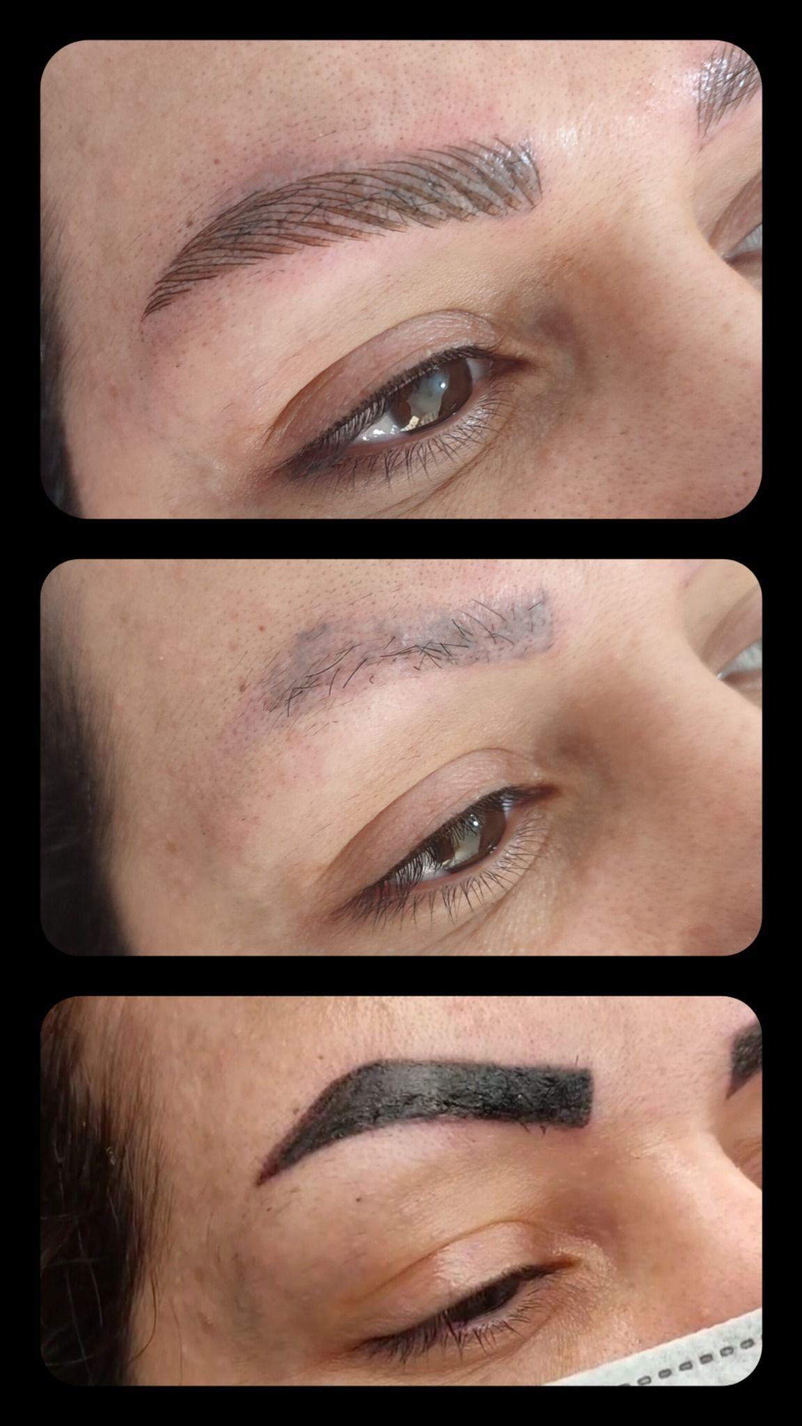 مرکز خدمات و آموزش میکروبلیدینگ ، میکروپیگمنتیشن و ریموو