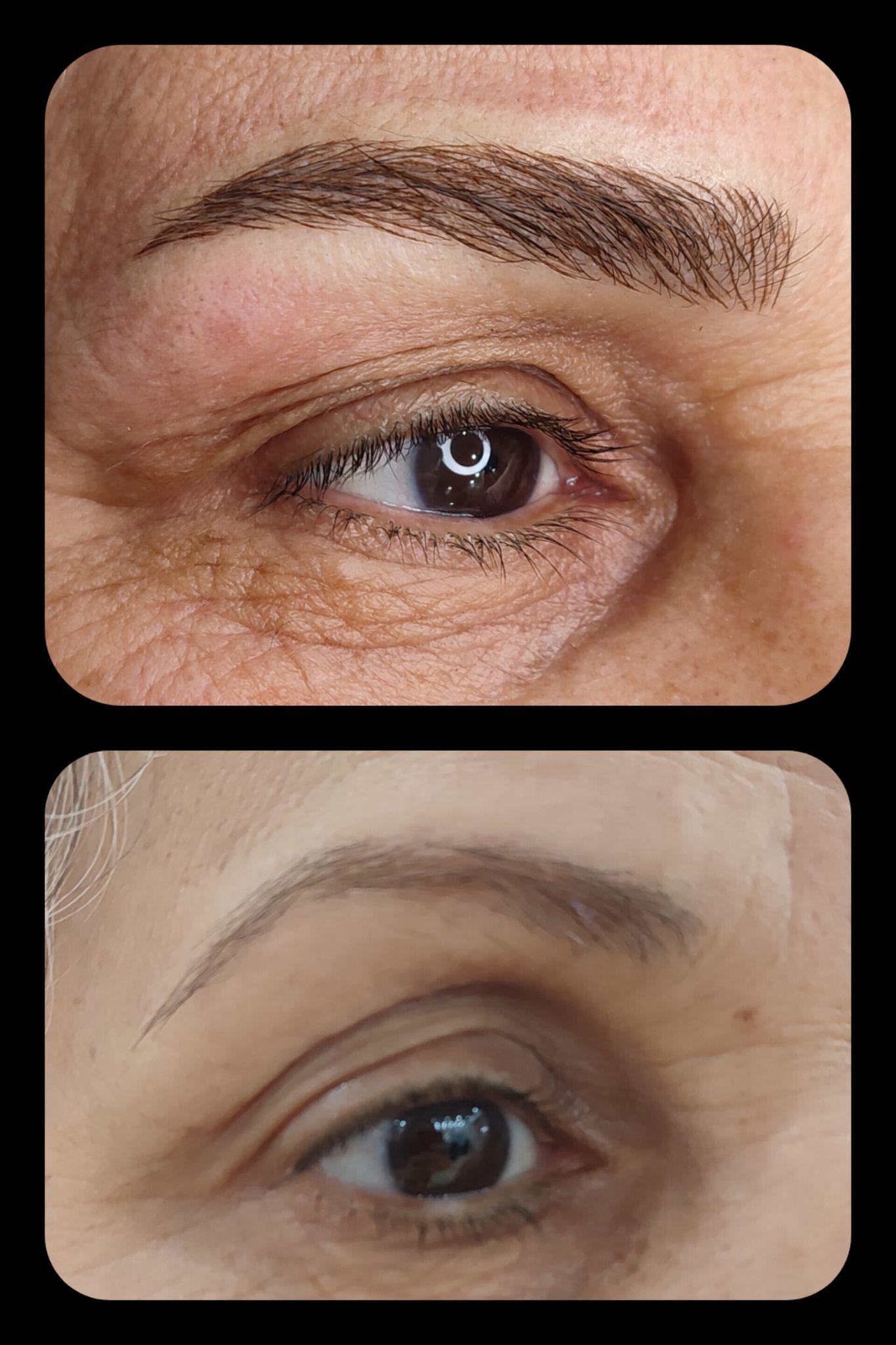 مرکز خدمات و آموزش میکروبلیدینگ ، میکروپیگمنتیشن و ریموو