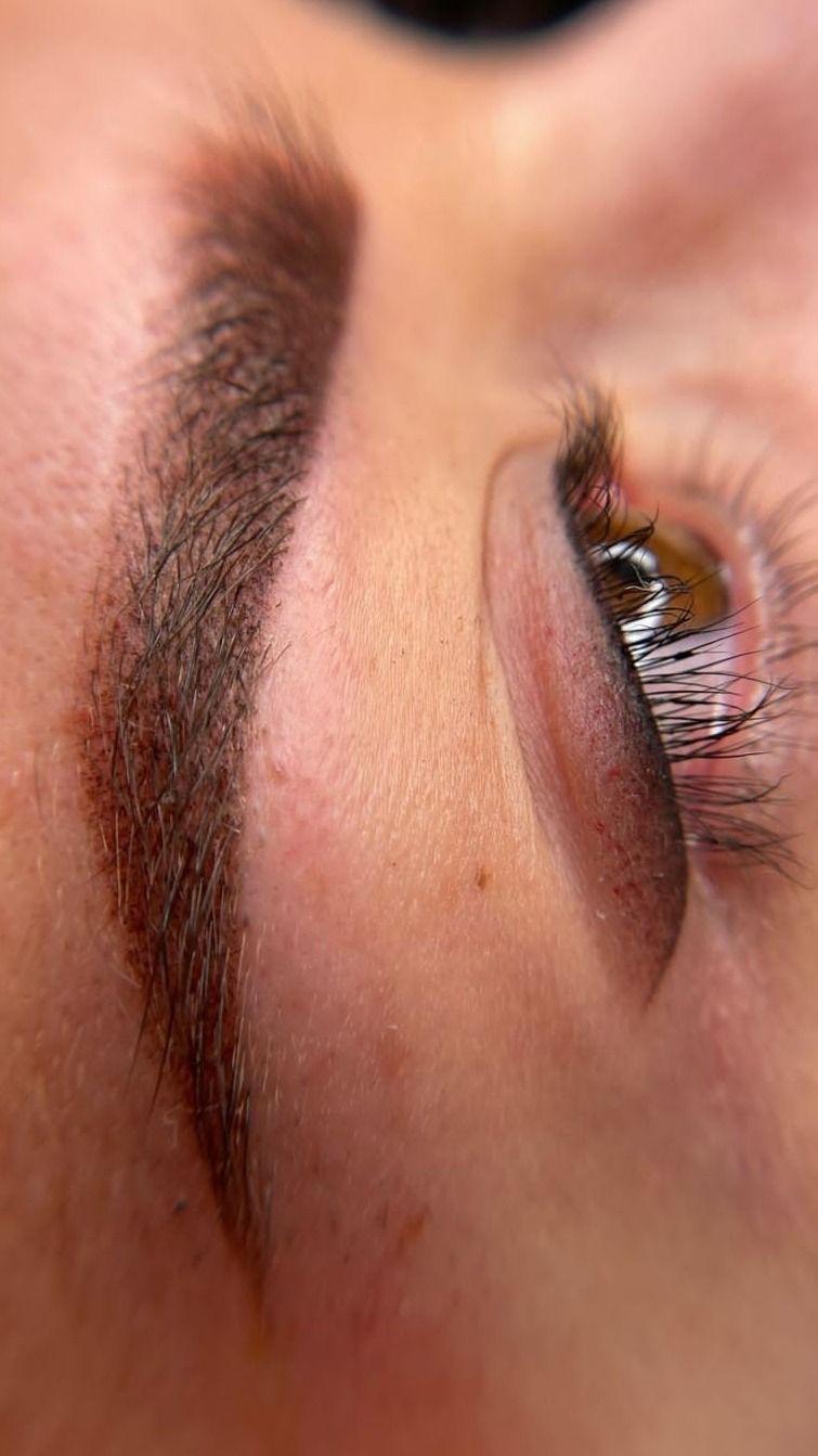 مرکز خدمات و آموزش میکروبلیدینگ ، میکروپیگمنتیشن و ریموو