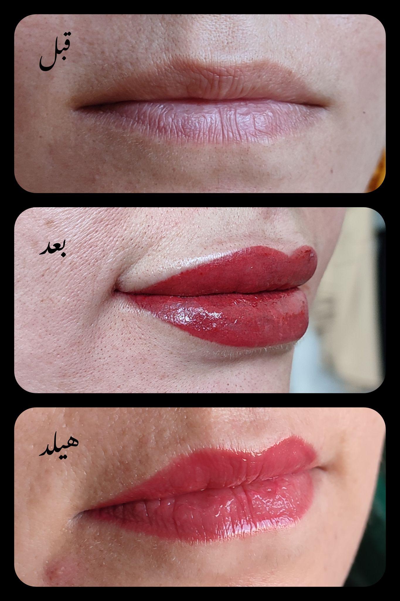 مرکز خدمات و آموزش میکروبلیدینگ ، میکروپیگمنتیشن و ریموو