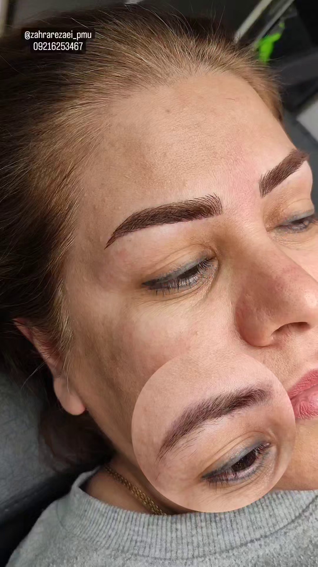 مرکز خدمات و آموزش میکروبلیدینگ ، میکروپیگمنتیشن و ریموو