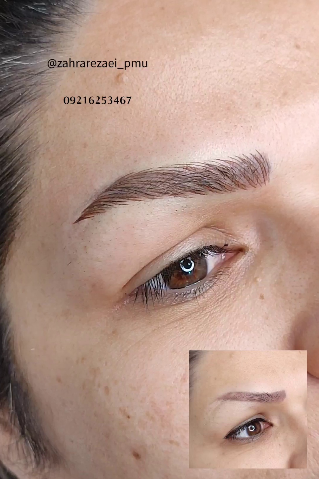 مرکز خدمات و آموزش میکروبلیدینگ ، میکروپیگمنتیشن و ریموو