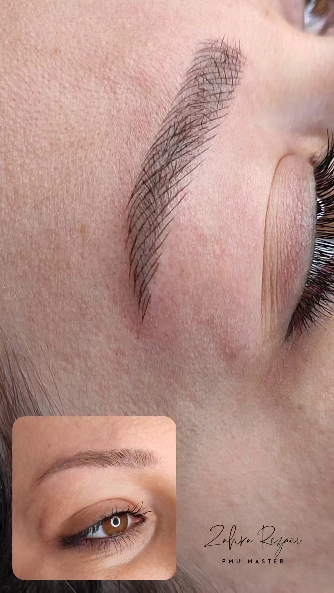 مرکز خدمات و آموزش میکروبلیدینگ ، میکروپیگمنتیشن و ریموو