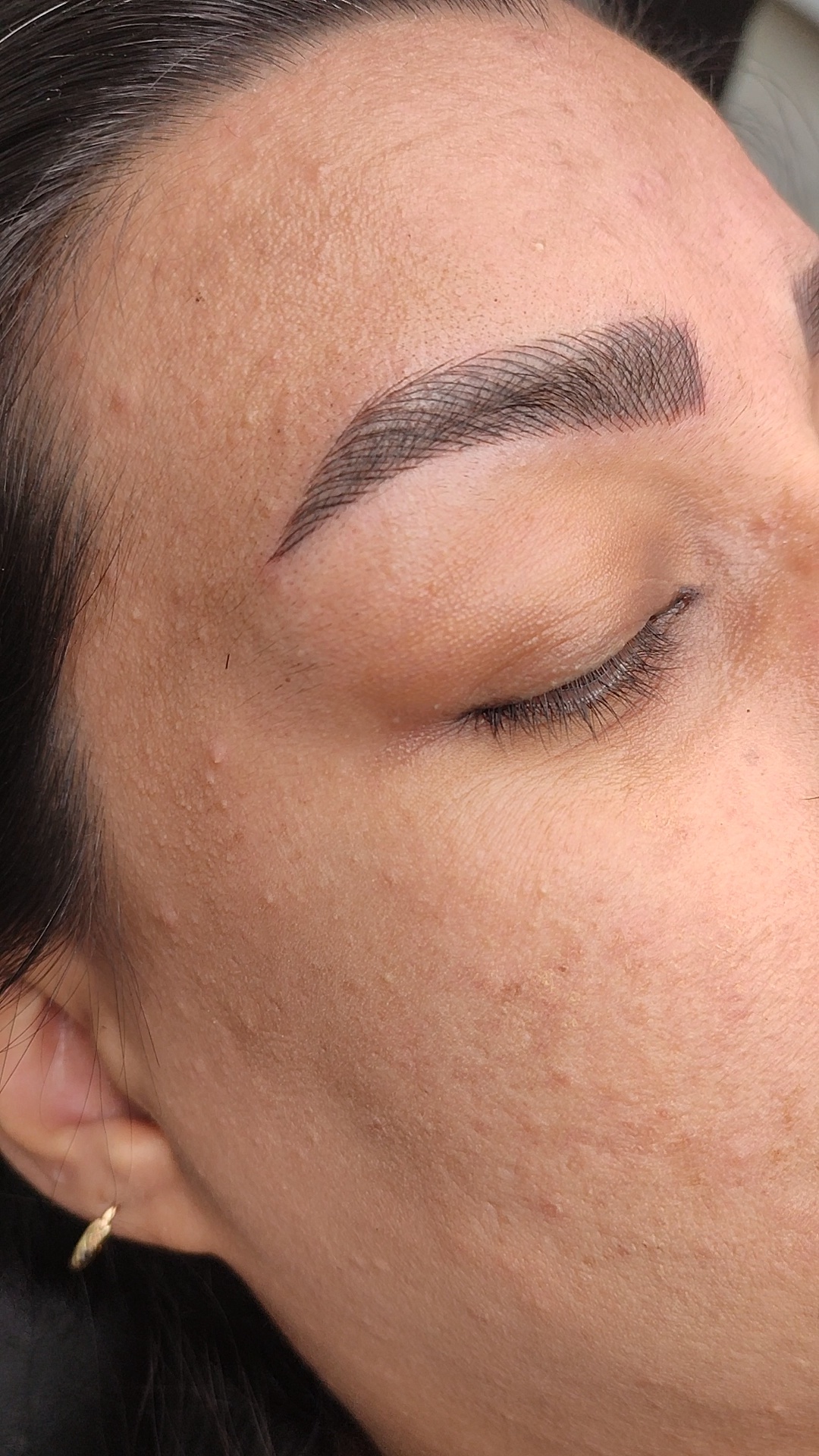 مرکز خدمات و آموزش میکروبلیدینگ ، میکروپیگمنتیشن و ریموو