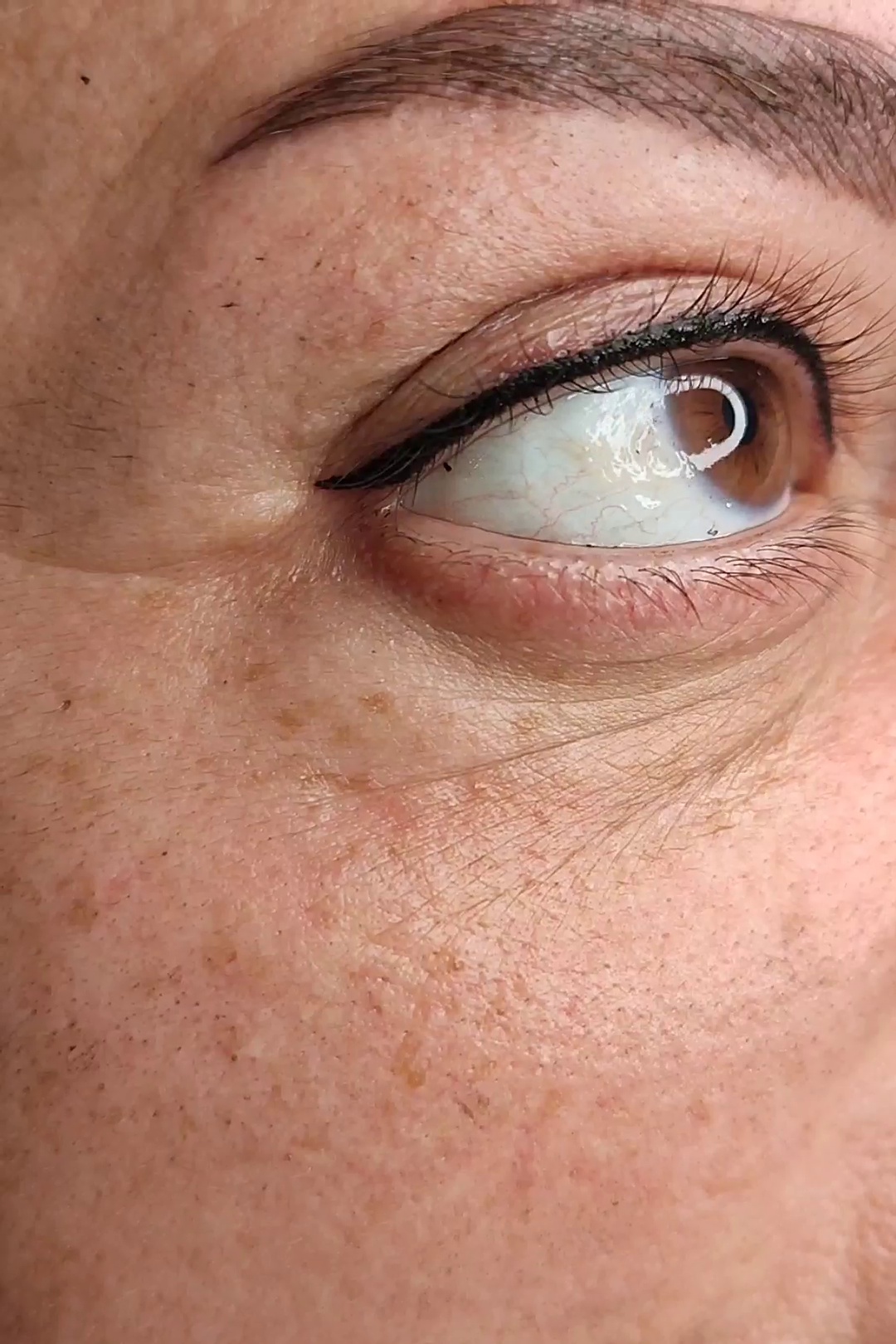 مرکز خدمات و آموزش میکروبلیدینگ ، میکروپیگمنتیشن و ریموو