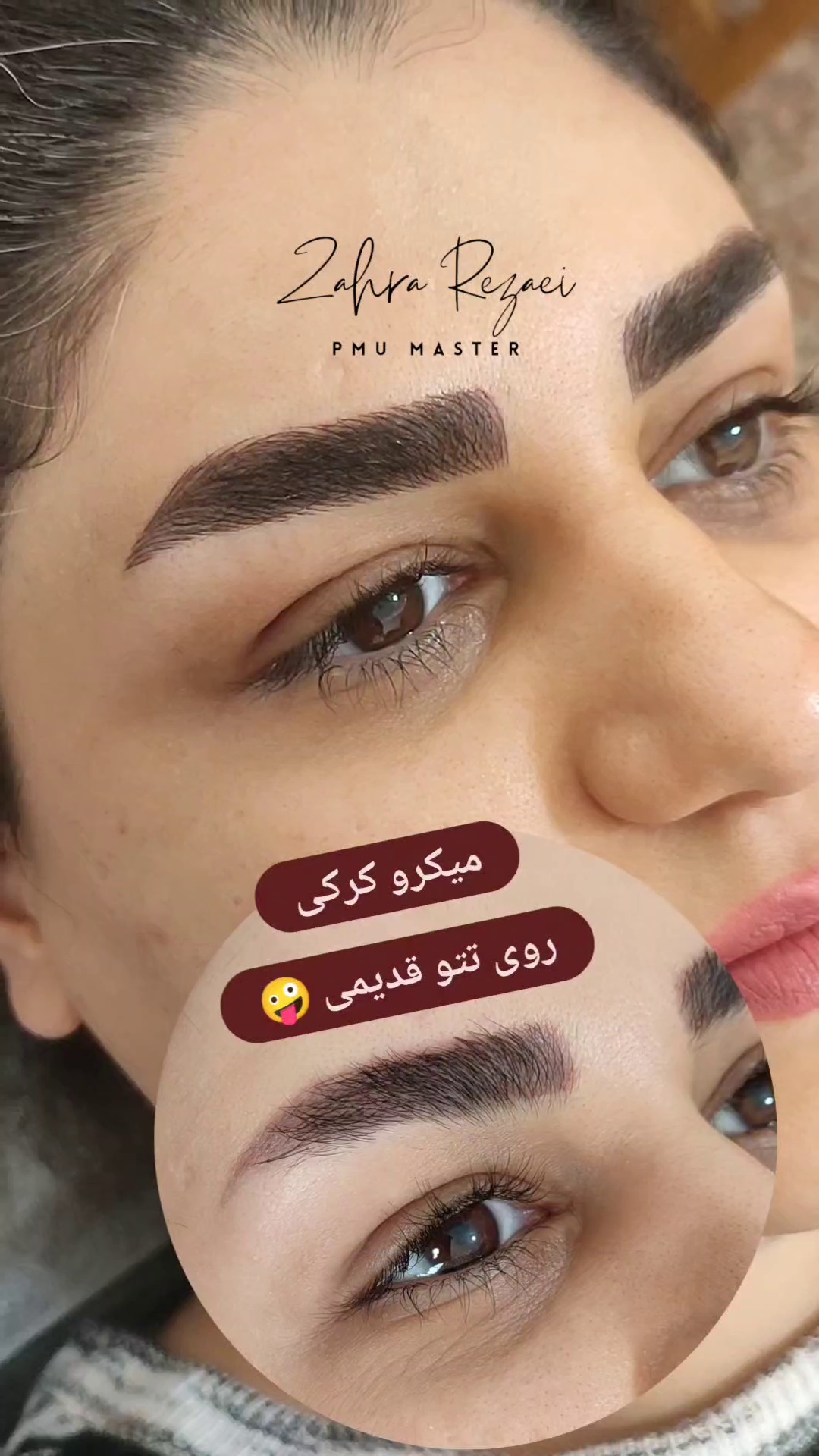 مرکز خدمات و آموزش میکروبلیدینگ ، میکروپیگمنتیشن و ریموو