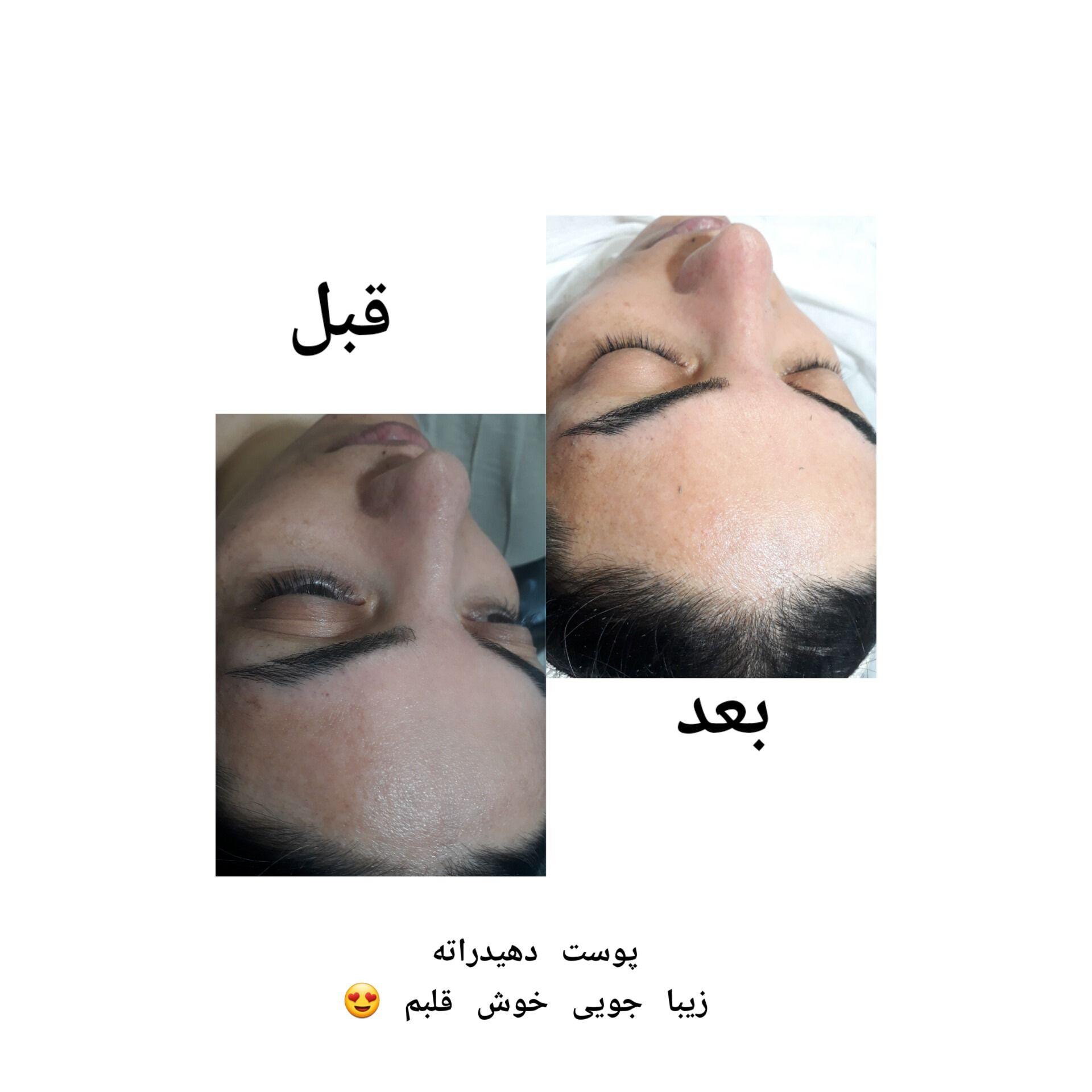 جوانسازی،پاکسازی وفیشیال تخصصی اتاق پوست آزیتا