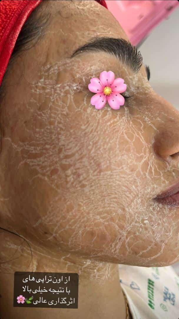 جوانسازی،پاکسازی وفیشیال تخصصی اتاق پوست آزیتا