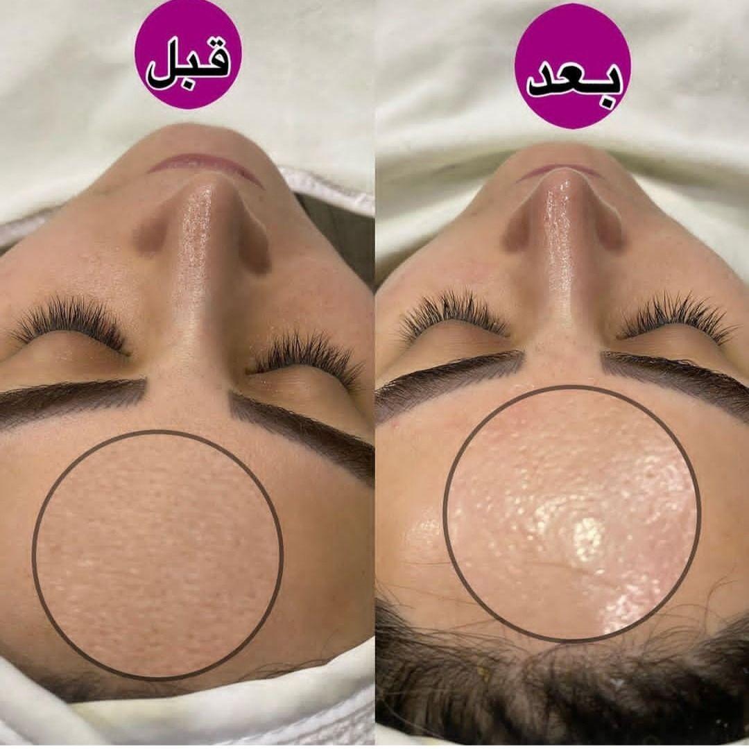 جوانسازی،پاکسازی وفیشیال تخصصی اتاق پوست آزیتا