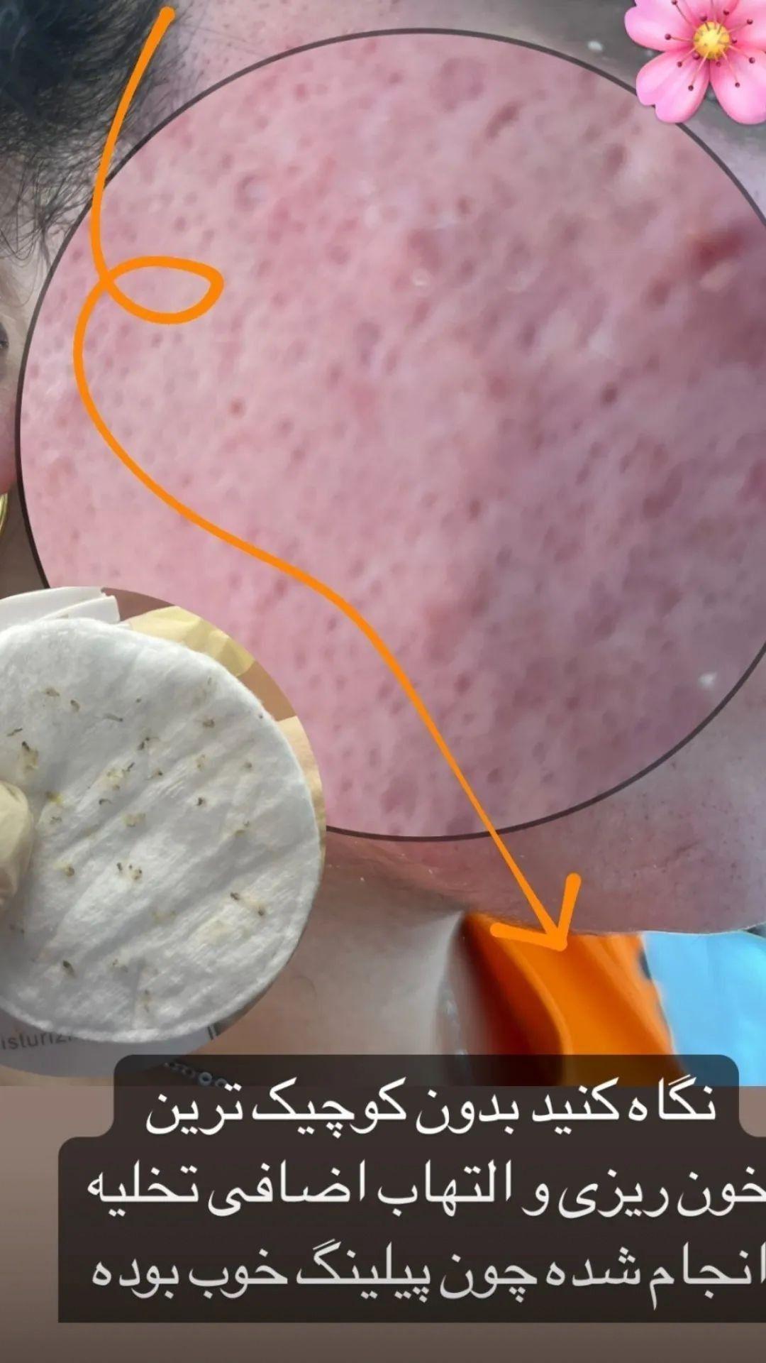 جوانسازی،پاکسازی وفیشیال تخصصی اتاق پوست آزیتا