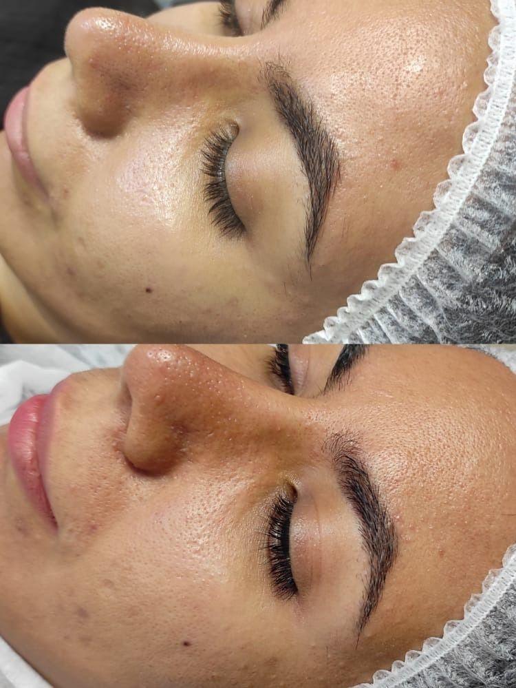 جوانسازی،پاکسازی وفیشیال تخصصی اتاق پوست آزیتا