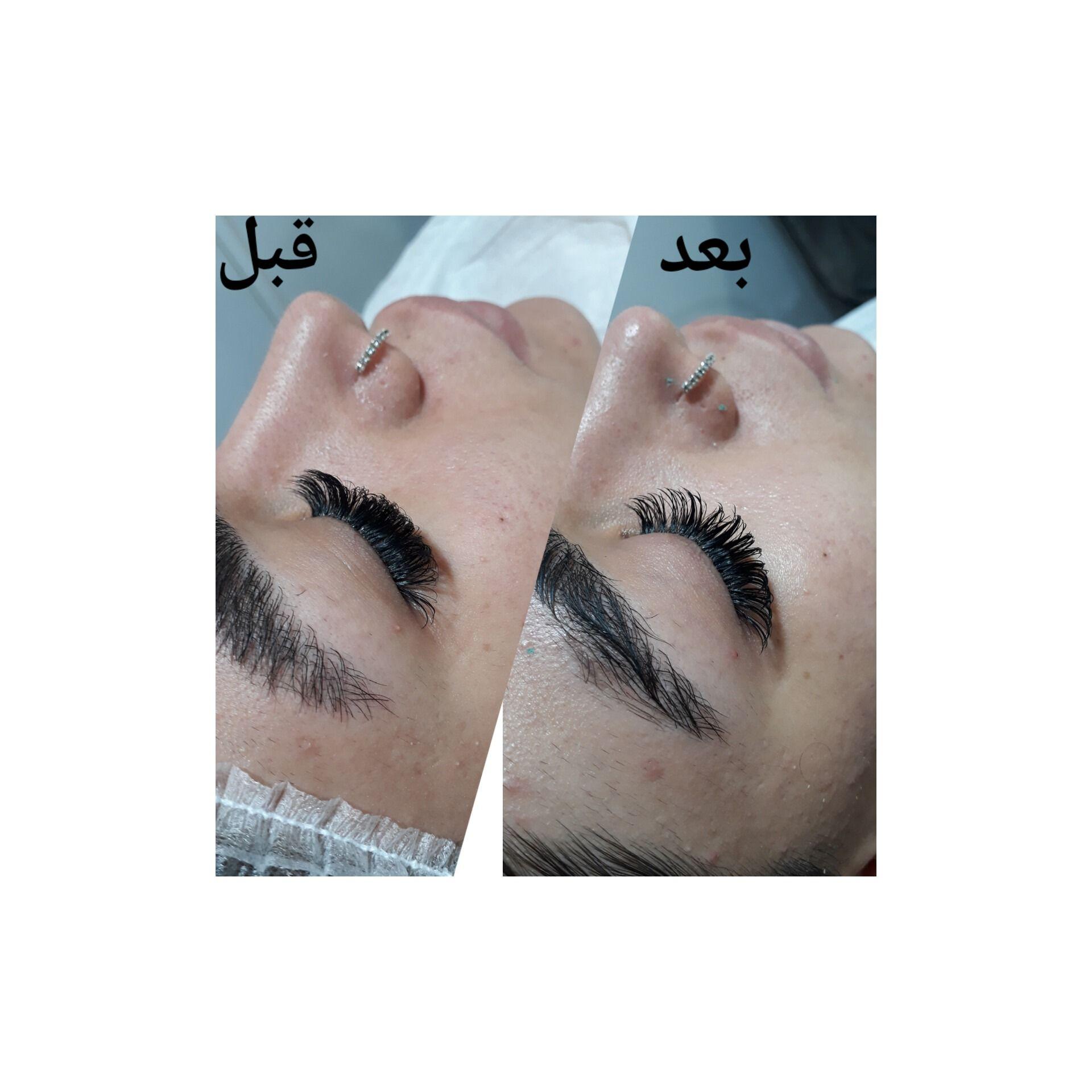 جوانسازی،پاکسازی وفیشیال تخصصی اتاق پوست آزیتا