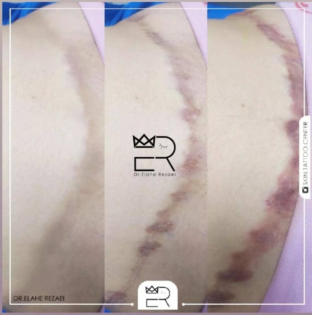 کلینیک تخصصی مدیکال تتو و زیبایی