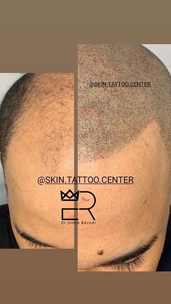 کلینیک تخصصی مدیکال تتو و زیبایی