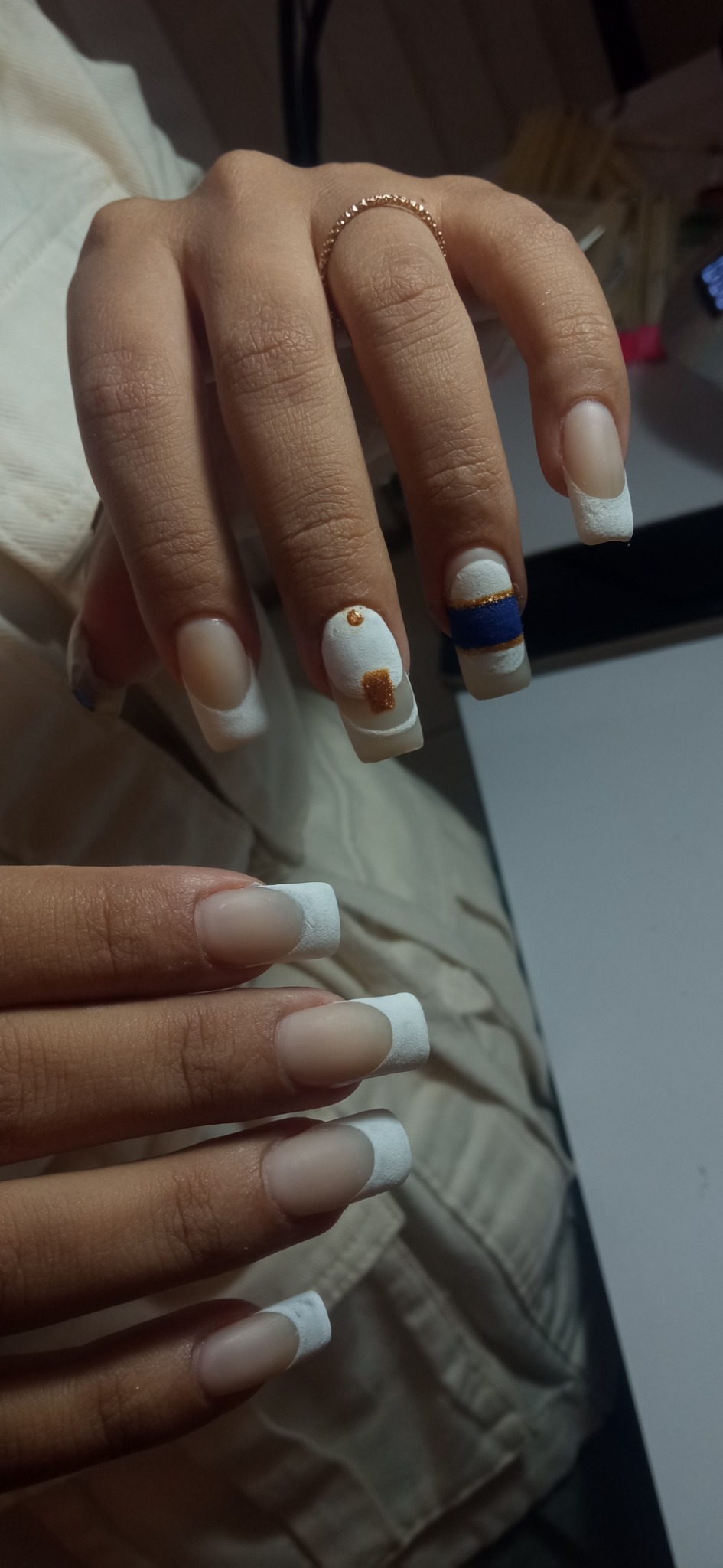 کاشت ناخن کرمان آزادی