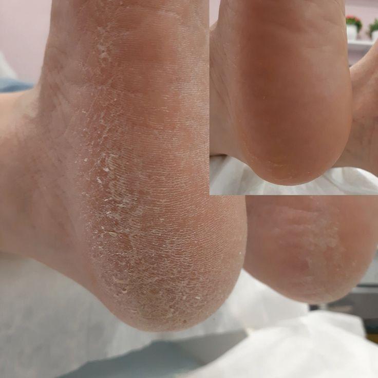 مرکز ناخن سلین