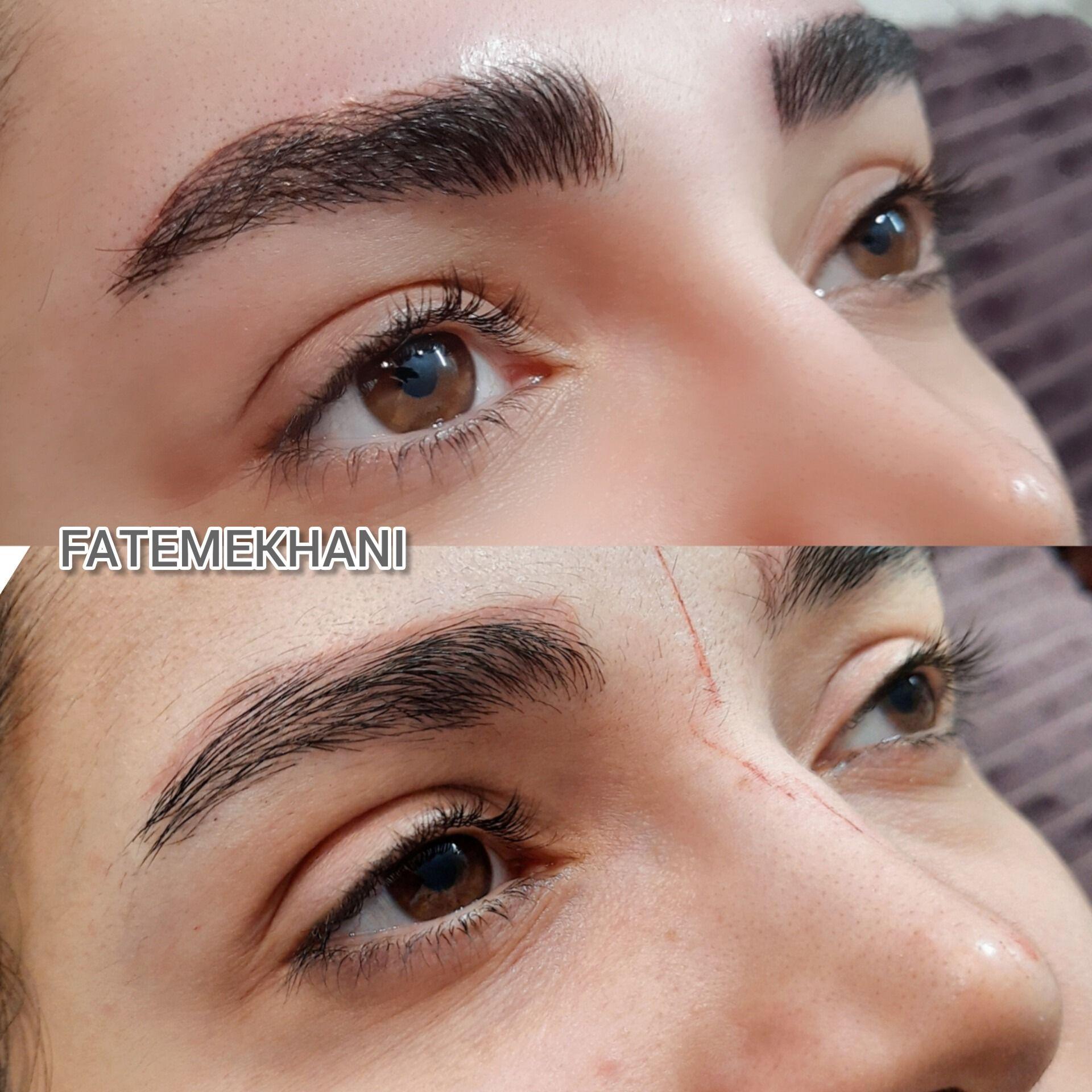 میکرو بلیدینگ و تتو بدن و کاشت ناخن