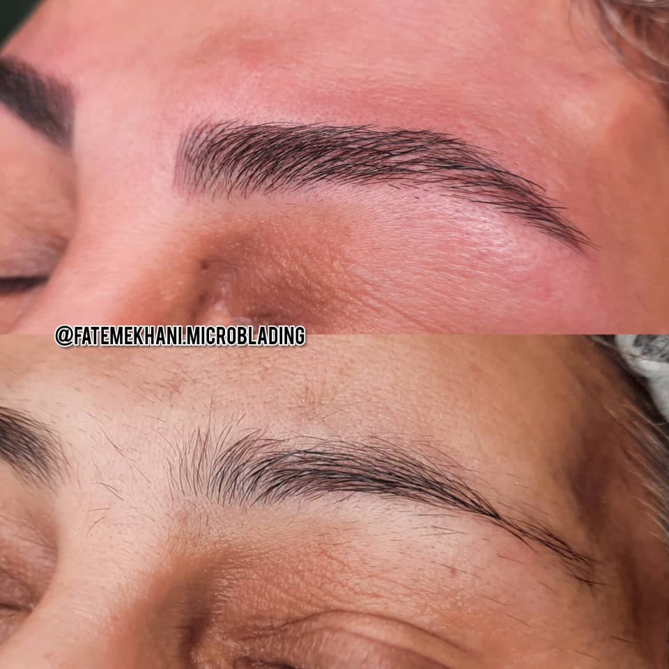 میکرو بلیدینگ و تتو بدن و کاشت ناخن