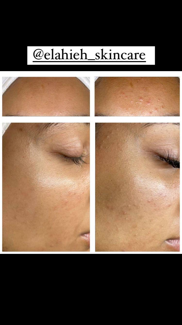 پاکسازی پوست و درمان مشکلات پوستی
