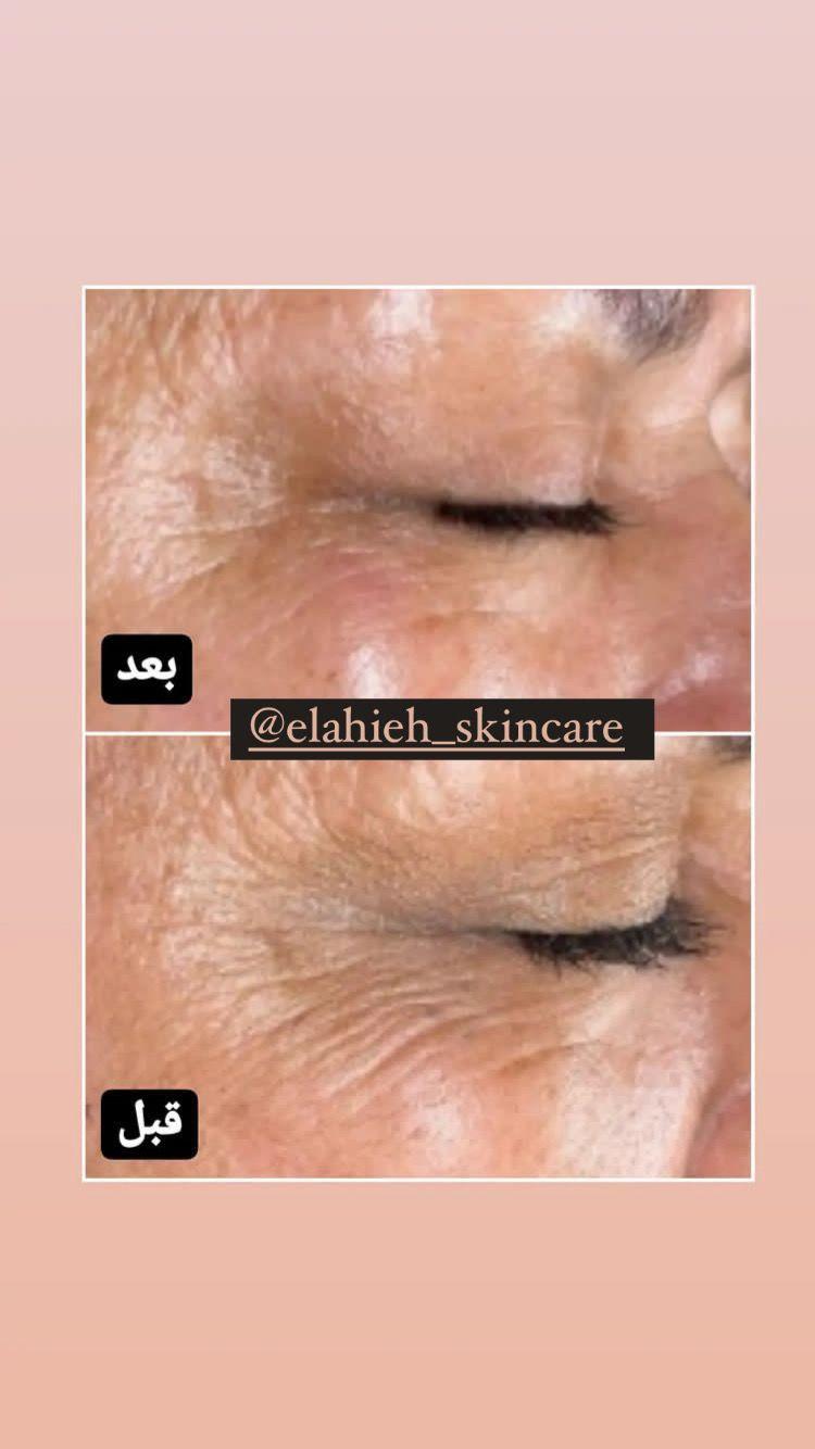 پاکسازی پوست و درمان مشکلات پوستی