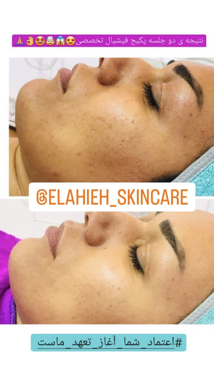 پاکسازی پوست و درمان مشکلات پوستی